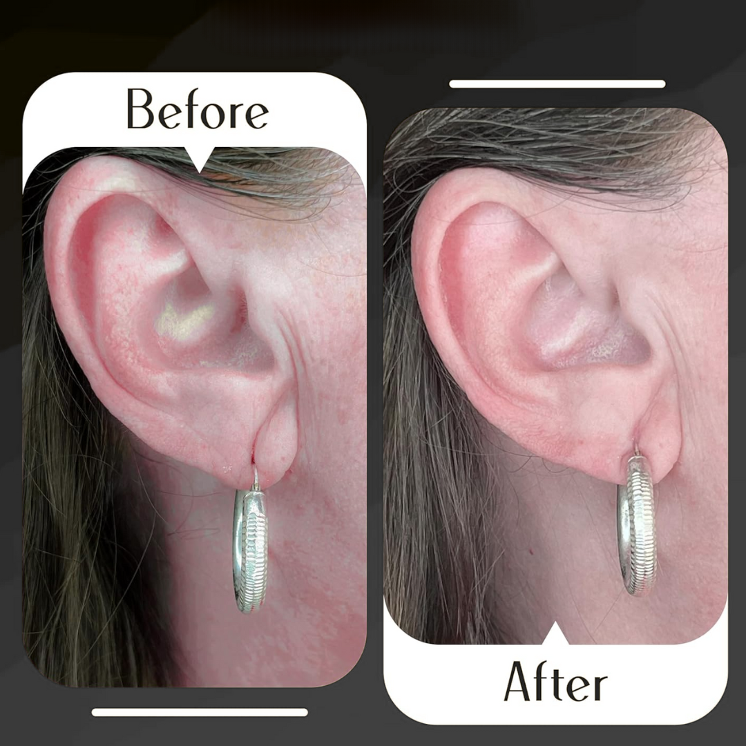 LobeLift™  Invisible Earrings Support Patches for Girls & Women (100 PCS)