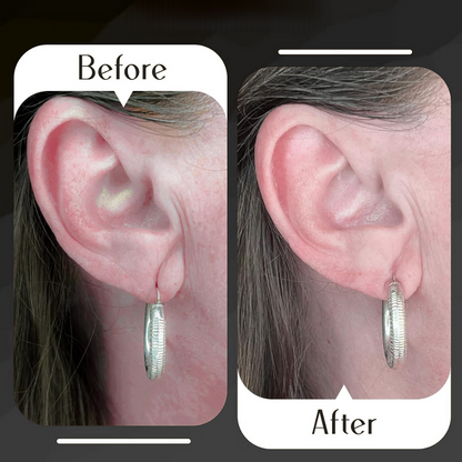 LobeLift™  Invisible Earrings Support Patches for Girls & Women (100 PCS)